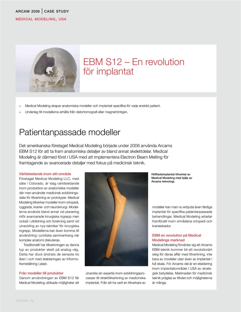 Patientanpassade modeller Det amerikanska företaget Medical Modeling började under 2006 använda Arcams EBM S12 för att ta fram anatomiska detaljer av bland annat skelettdelar.