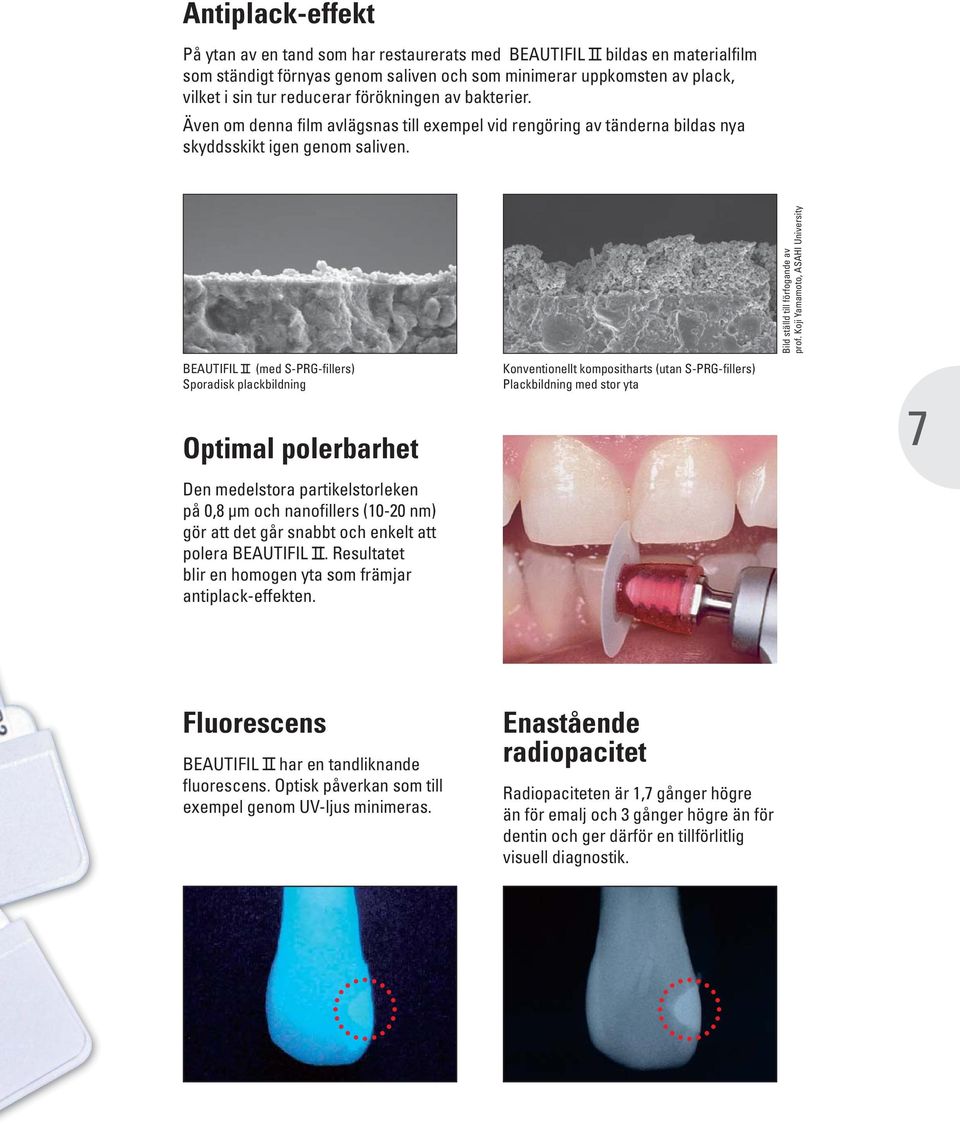 Koji Yamamoto, ASAHI University BEAUTIFIL (med S-PRG-fillers) Sporadisk plackbildning Optimal polerbarhet Den medelstora partikelstorleken på 0,8 μm och nanofillers (10-20 nm) gör att det går snabbt