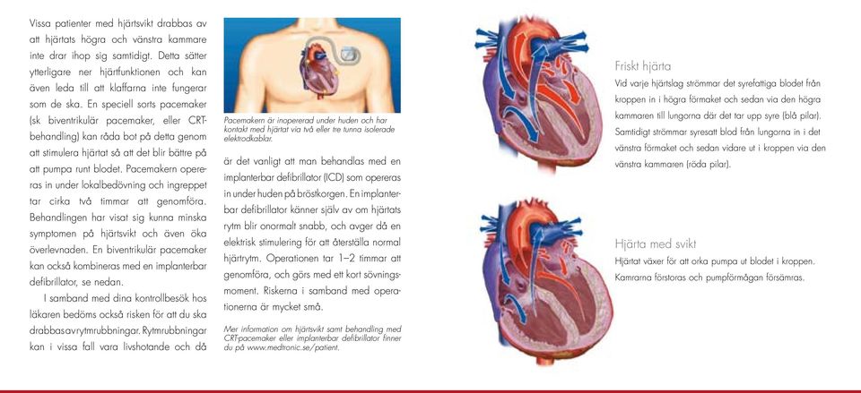 En speciell sorts pacemaker (sk biventrikulär pacemaker, eller CRTbehandling) kan råda bot på detta genom att stimulera hjärtat så att det blir bättre på att pumpa runt blodet.