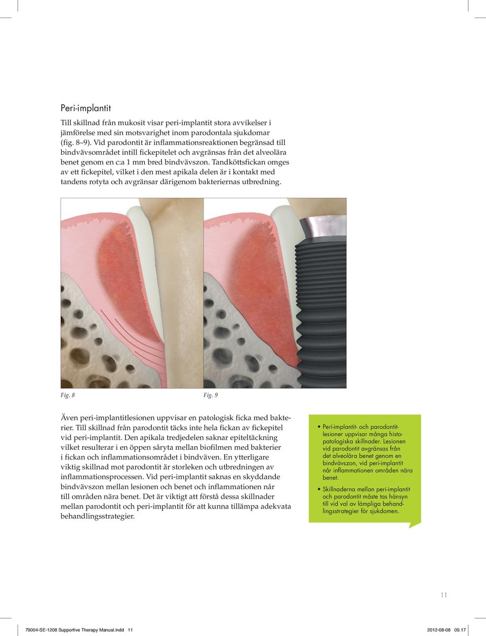 Tandköttsfickan omges av ett fickepitel, vilket i den mest apikala delen är i kontakt med tandens rotyta och avgränsar därigenom bakteriernas utbredning. Fig. 8 Fig.