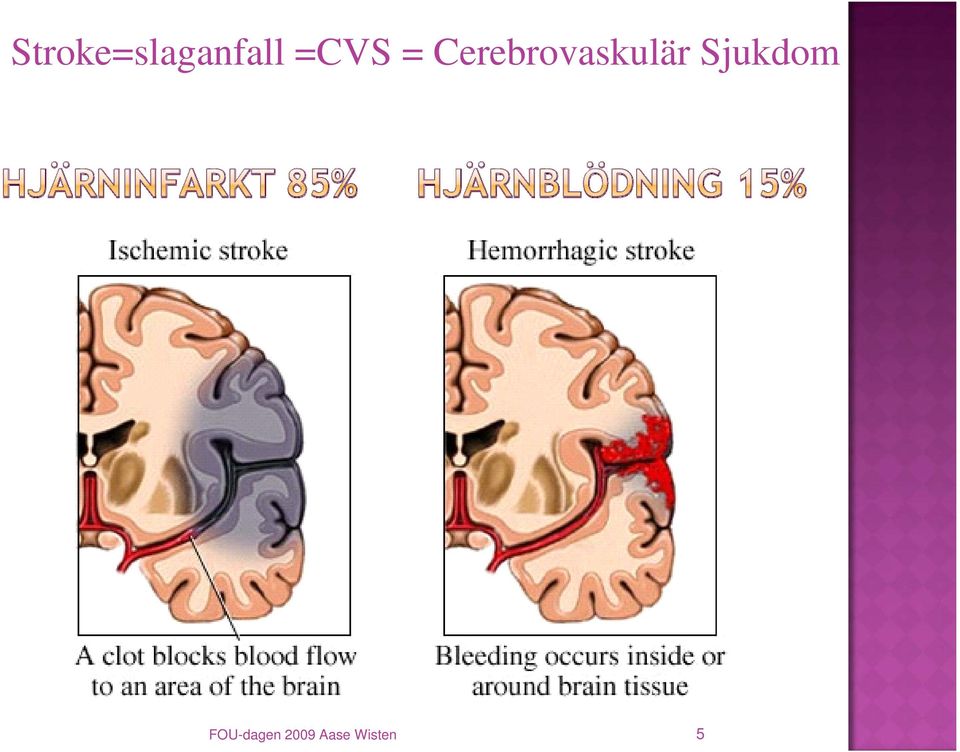 Cerebrovaskulär