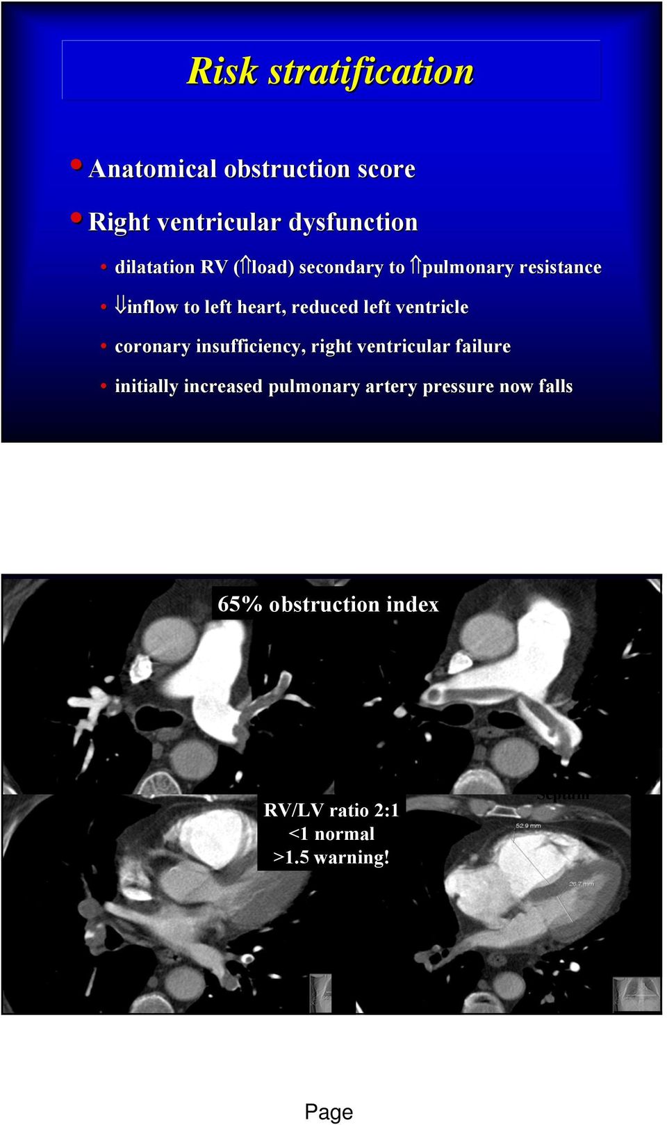 left ventricle coronary insufficiency, right ventricular failure initially increased