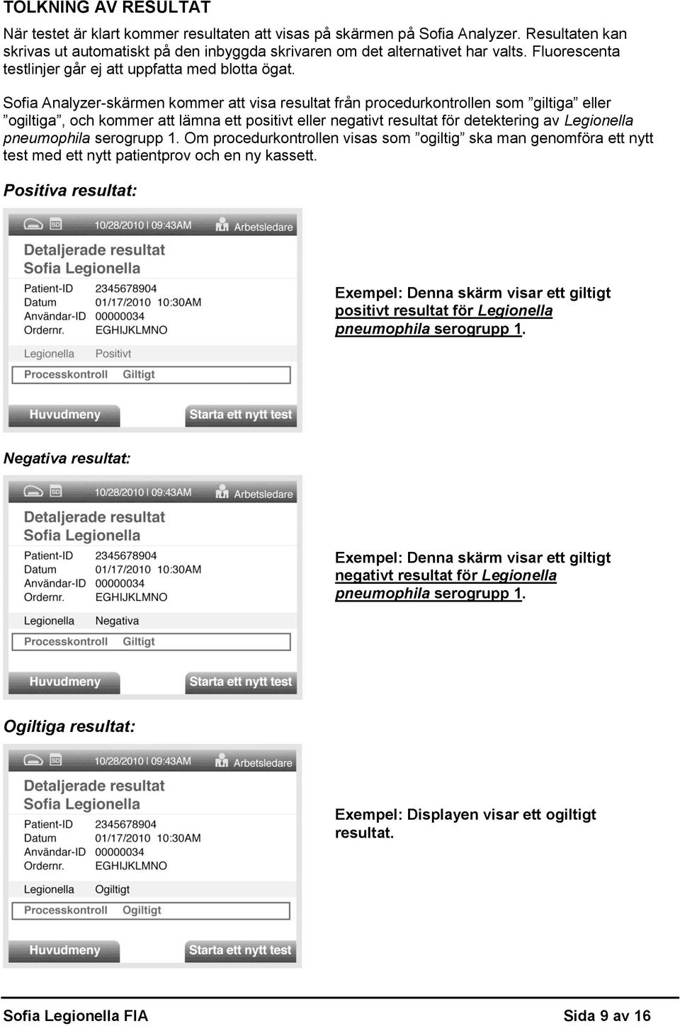 Sofia Analyzer-skärmen kommer att visa resultat från procedurkontrollen som giltiga eller ogiltiga, och kommer att lämna ett positivt eller negativt resultat för detektering av Legionella pneumophila
