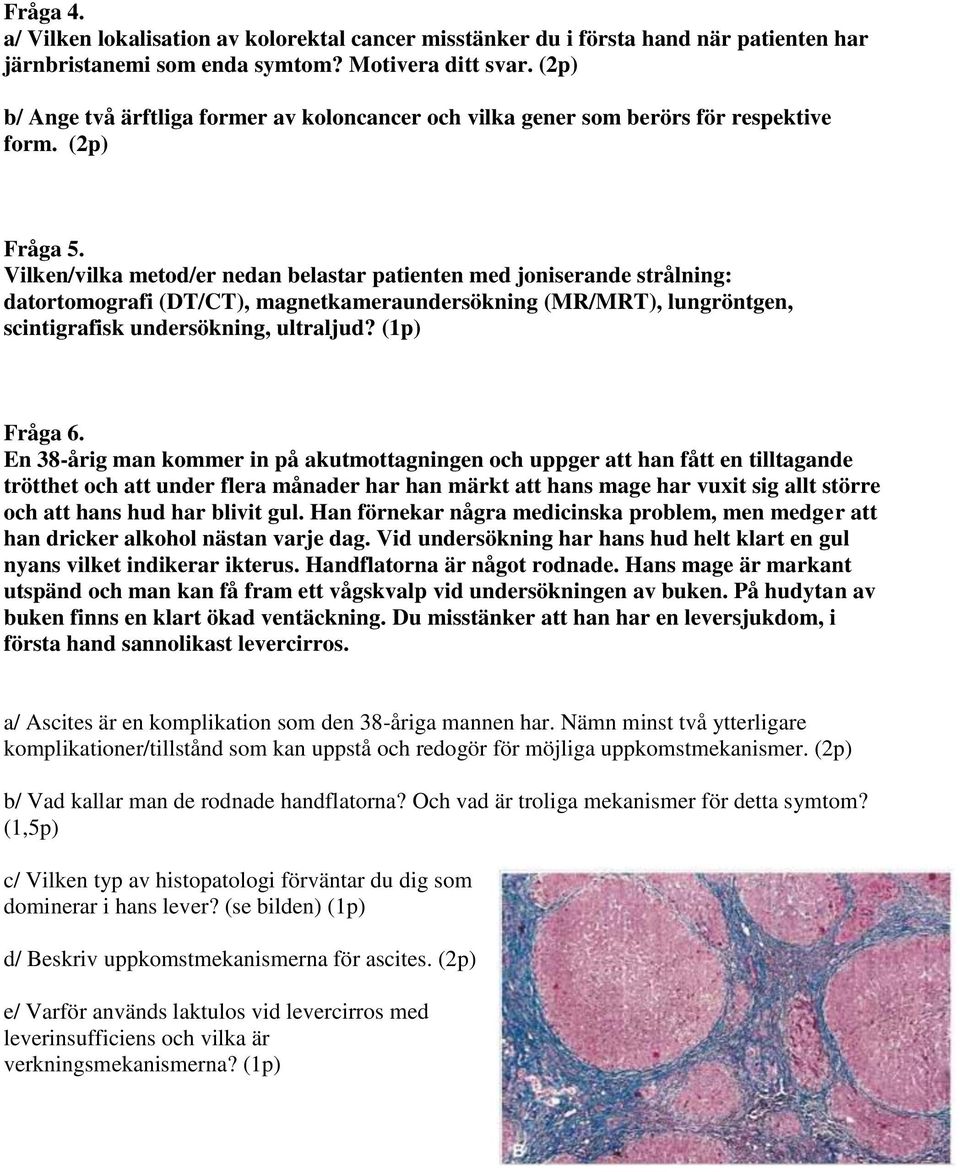 Vilken/vilka metod/er nedan belastar patienten med joniserande strålning: datortomografi (DT/CT), magnetkameraundersökning (MR/MRT), lungröntgen, scintigrafisk undersökning, ultraljud? (1p) Fråga 6.