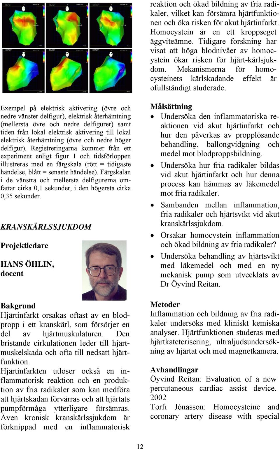 Exempel på elektrisk aktivering (övre och nedre vänster delfigur), elektrisk återhämtning (mellersta övre och nedre delfigurer) samt tiden från lokal elektrisk aktivering till lokal elektrisk