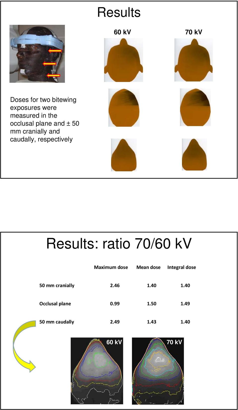 ratio 70/60 kv Maximum dose Mean dose Integral dose 50 mm cranially 2.46 1.