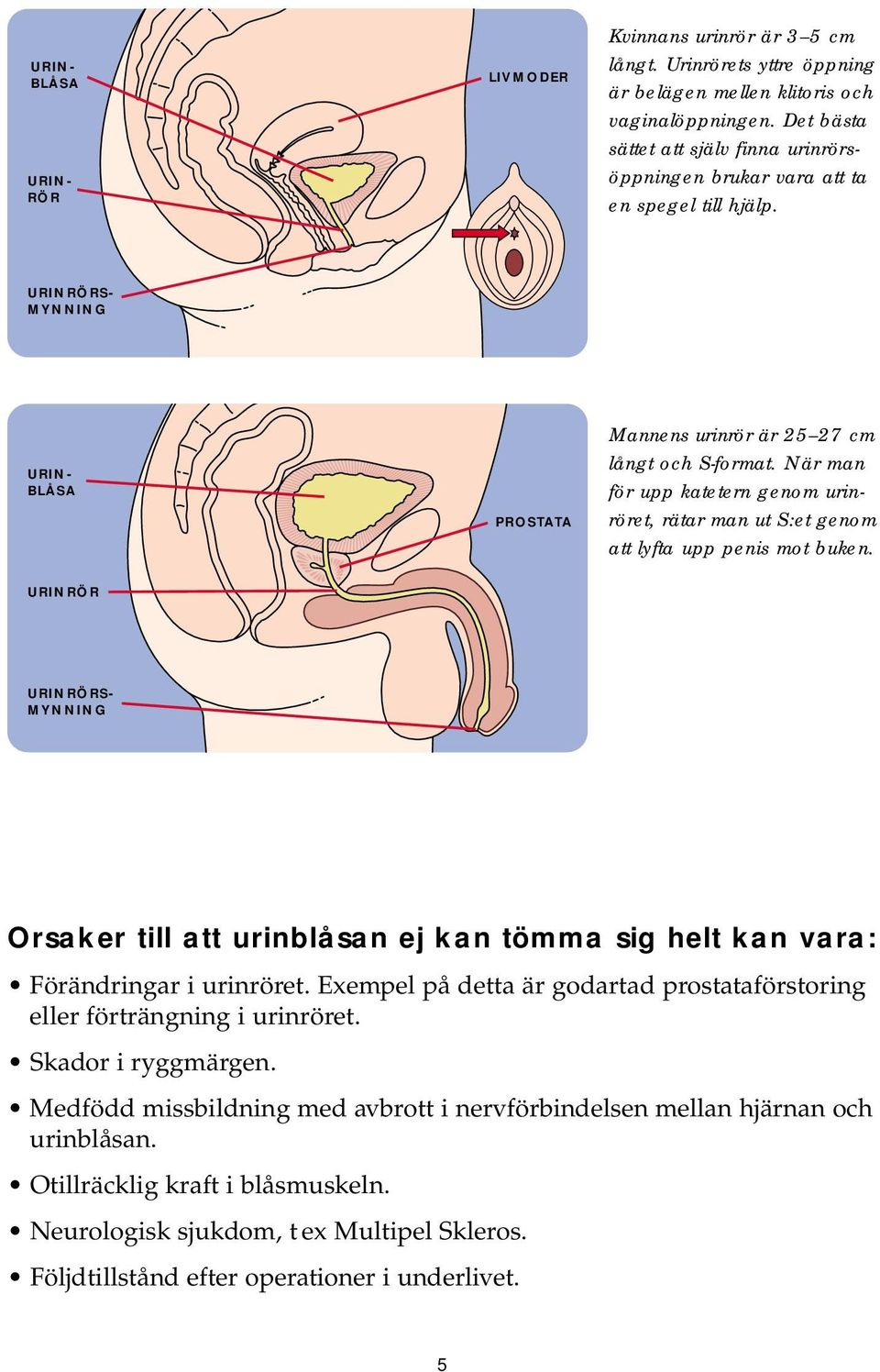 När man för upp katetern genom urinröret, rätar man ut S:et genom att lyfta upp penis mot buken.