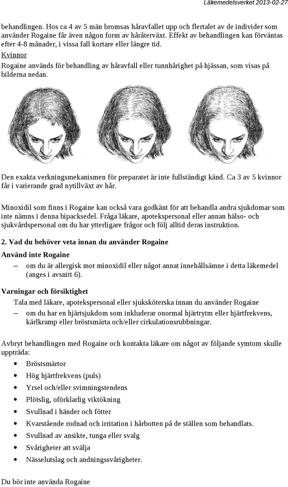 Kvinnor Rogaine används för behandling av håravfall eller tunnhårighet på hjässan, som visas på bilderna nedan. Den exakta verkningsmekanismen för preparatet är inte fullständigt känd.