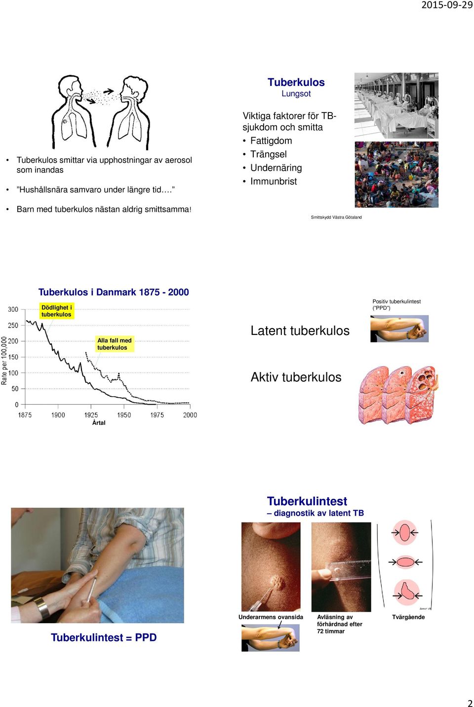 Viktiga faktorer för TBsjukdom och smitta Fattigdom Trängsel Undernäring Immunbrist Smittskydd Västra Götaland Tuberkulos i Danmark