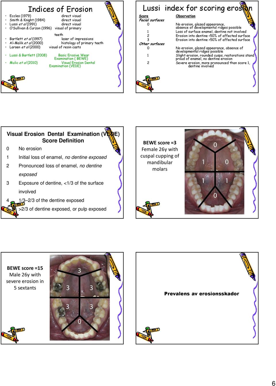 Dental Examination (VEDE) Lussi index for scoring erosion Score Observation Facial surfaces 0 No erosion, glazed appearance, absence of developmental ridges possible 1 Loss of surface enamel, dentine