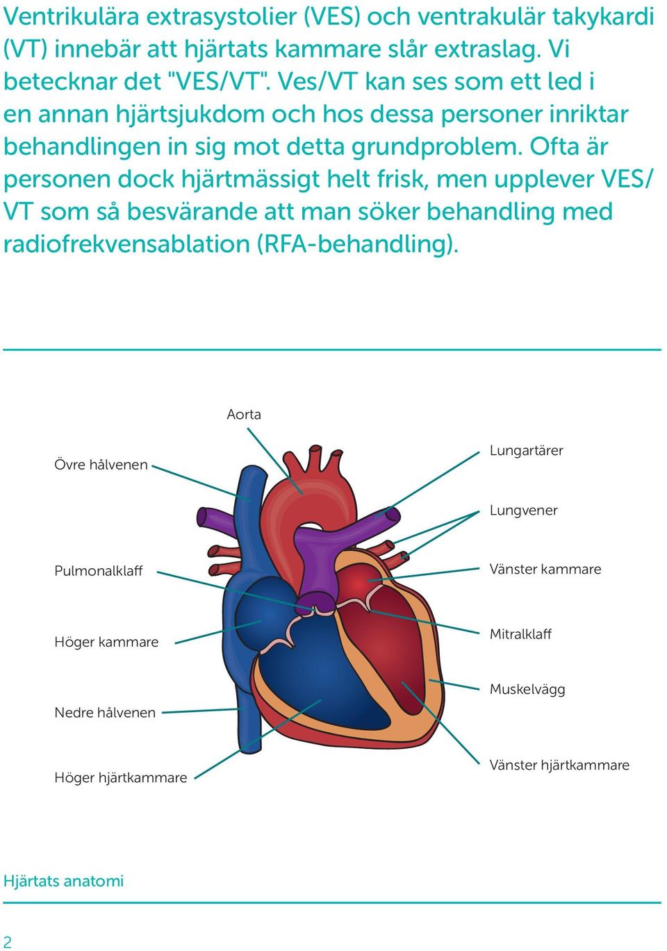 Ofta är personen dock hjärtmässigt helt frisk, men upplever VES/ VT som så besvärande att man söker behandling med radiofrekvensablation