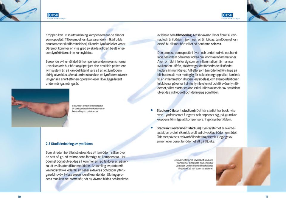 Beroende av hur väl de här kompenserande mekanismerna utvecklas och hur hårt angripet just den enskilde patientens lymfsystem är, så kan det ibland vara så att ett lymfödem aldrig utvecklas.