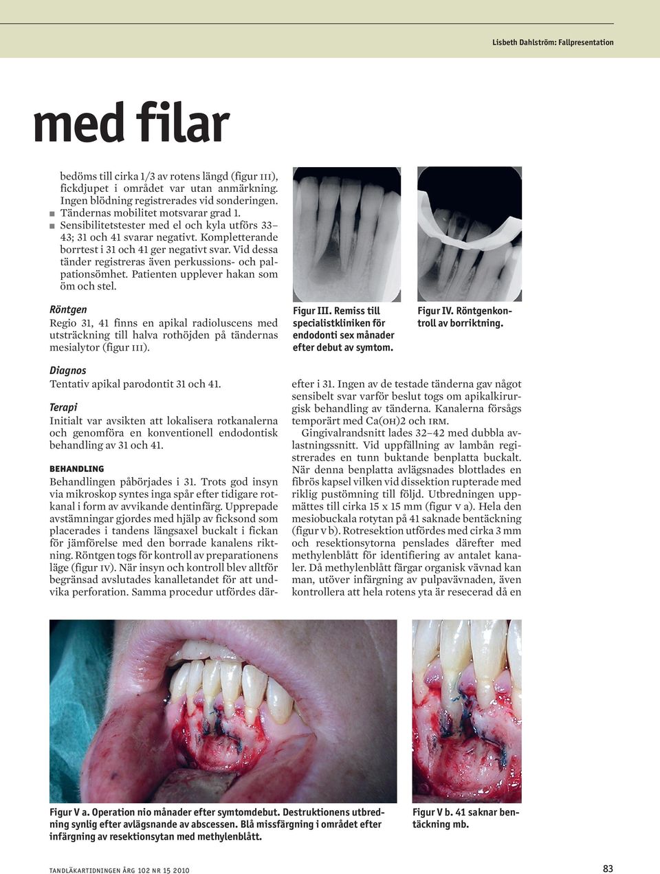 Vid dessa tänder registreras även perkussions- och palpationsömhet. Patienten upplever hakan som öm och stel.