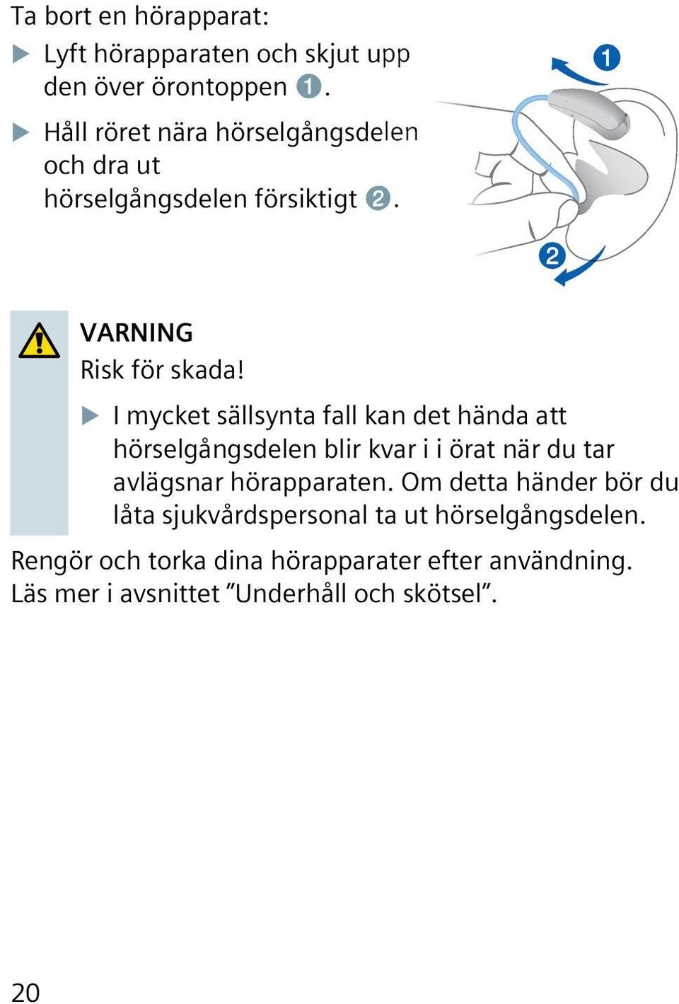 XXI mycket sällsynta fall kan det hända att hörselgångsdelen blir kvar i i örat när du tar avlägsnar hörapparaten.