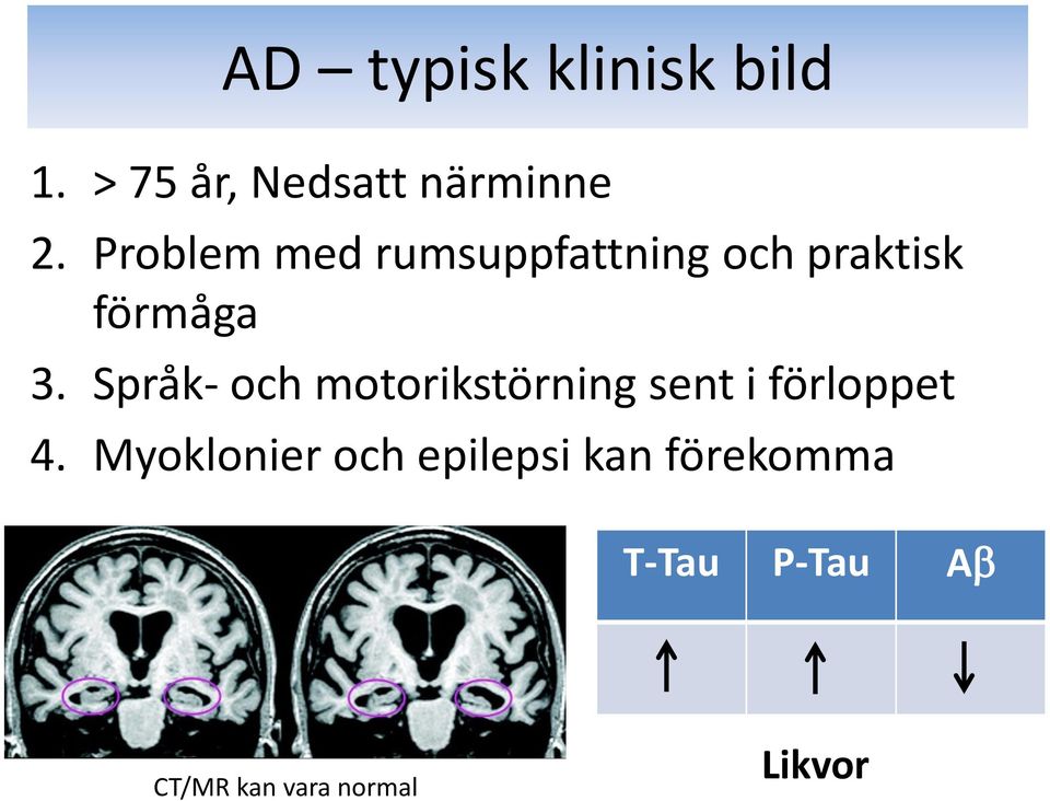 Språk- och motorikstörning sent i förloppet 4.