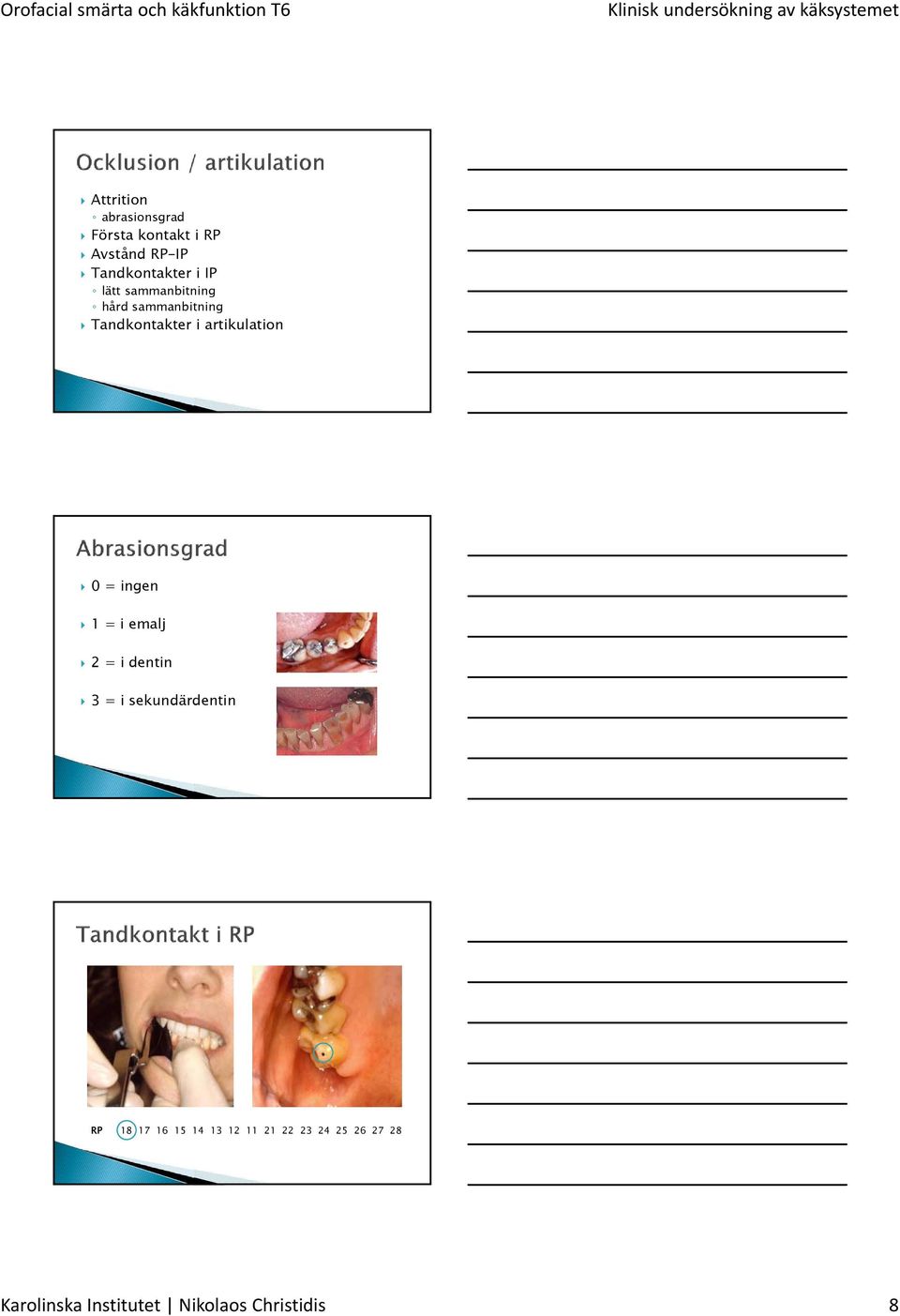 ingen 1 = i emalj 2 = i dentin 3 = i sekundärdentin RP 18 17 16 15 14 13