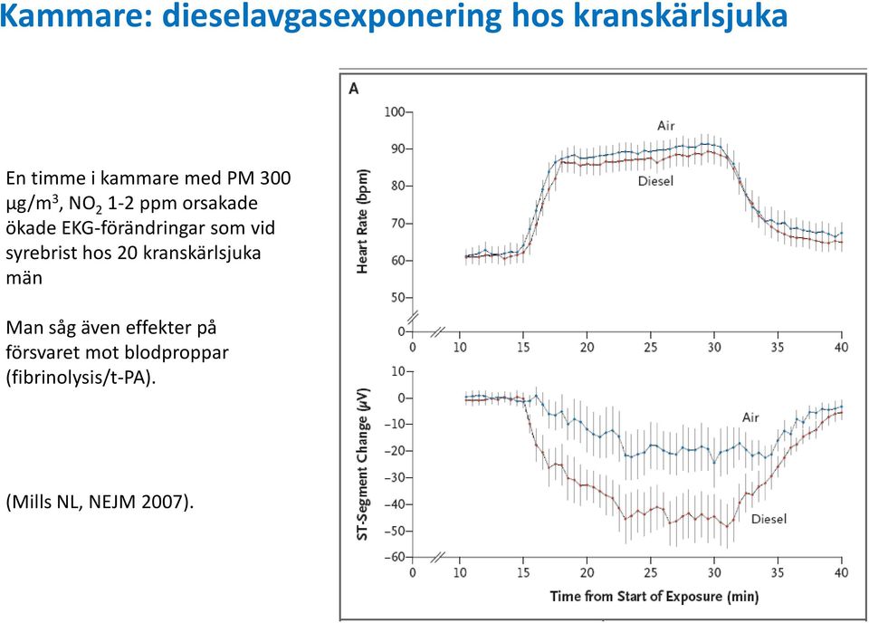 EKG-förändringar som vid syrebrist hos 20 kranskärlsjuka män Man