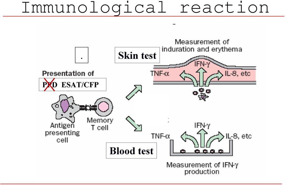 Skin test PPD