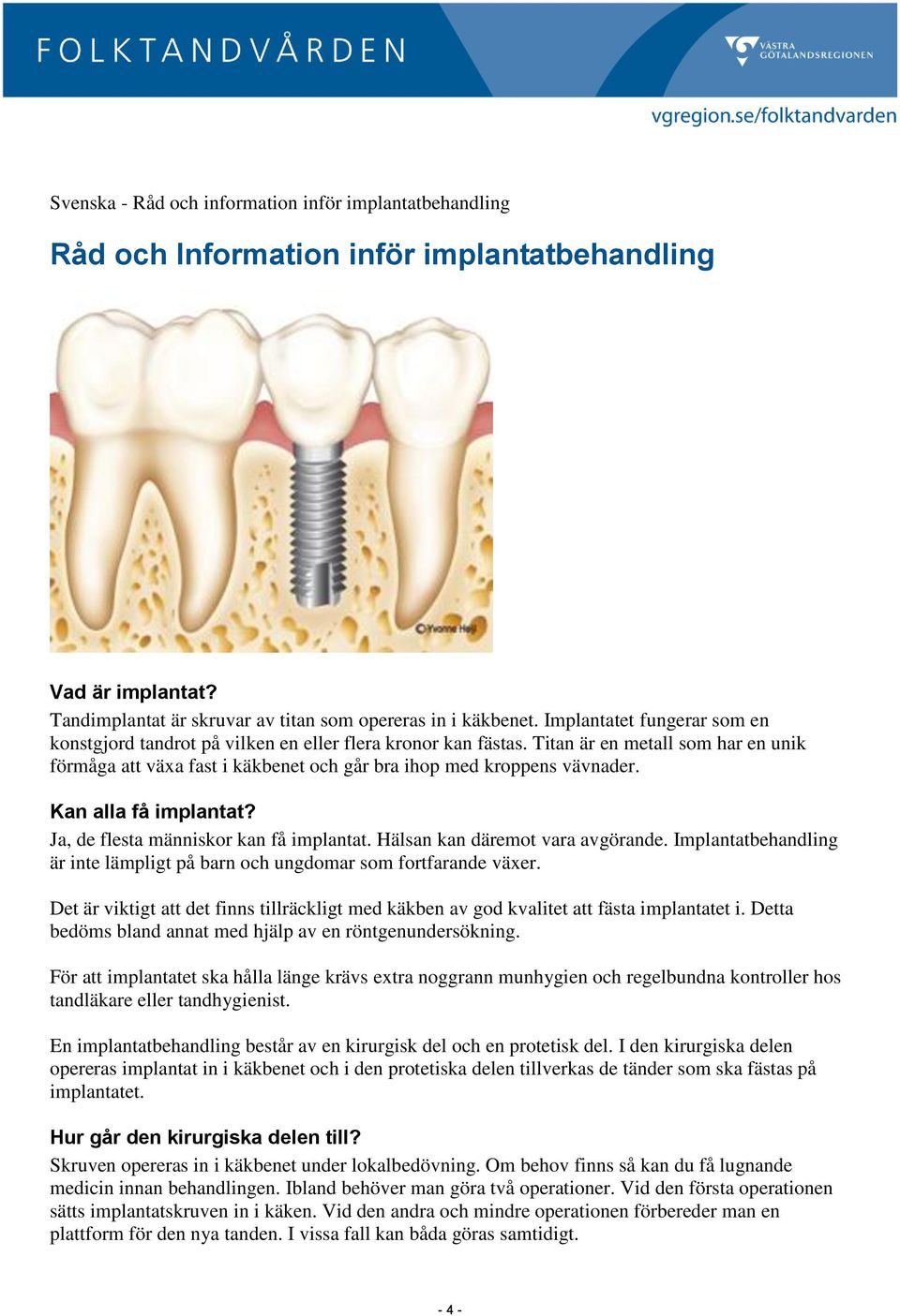 Kan alla få implantat? Ja, de flesta människor kan få implantat. Hälsan kan däremot vara avgörande. Implantatbehandling är inte lämpligt på barn och ungdomar som fortfarande växer.