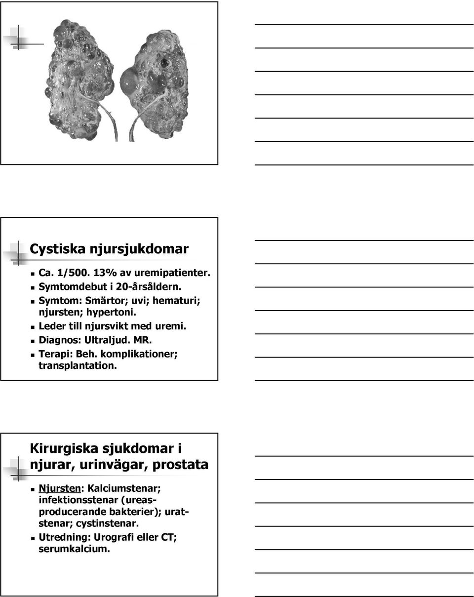 Terapi: Beh. komplikationer; transplantation.