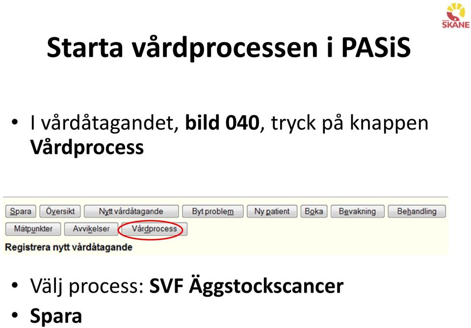 på knappen Vårdprocess Välj