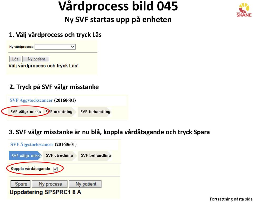 Tryck på SVF välgr misstanke 3.