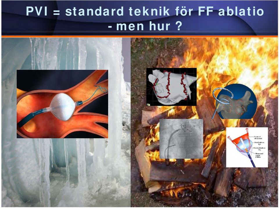 teknik för