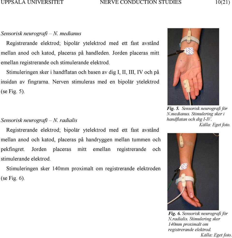 Nerven stimuleras med en bipolär ytelektrod (se Fig. 5). Sensorisk neurografi N.