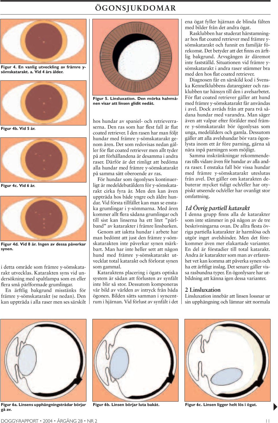 En ärftlig bakgrund misstänks för främre y-sömskatarakt (se nedan). Den kan uppträda i alla raser men ses särskilt ÖGONSJUKDOMAR Figur 5. Linsluxation.