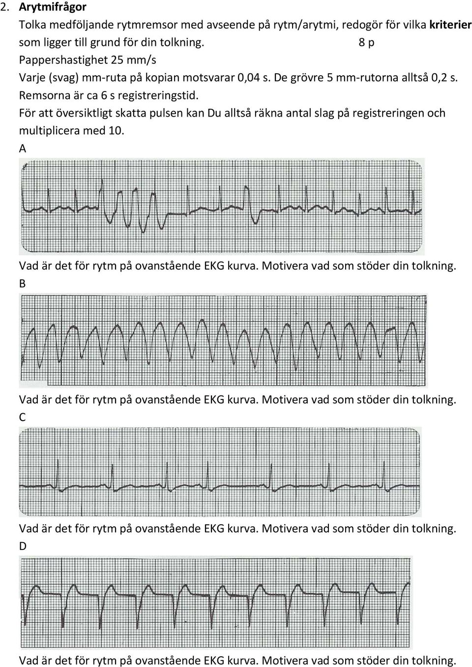 För att översiktligt skatta pulsen kan Du alltså räkna antal slag på registreringen och multiplicera med 10. A Vad är det för rytm på ovanstående EKG kurva.