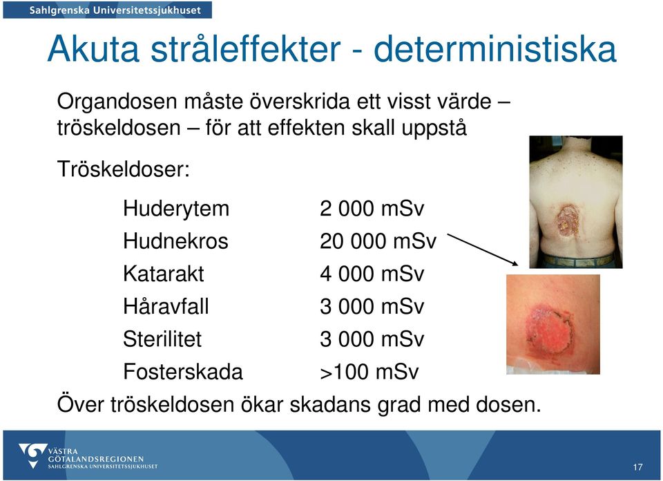 Hudnekros Katarakt Håravfall Sterilitet Fosterskada 2 000 msv 20 000 msv 4