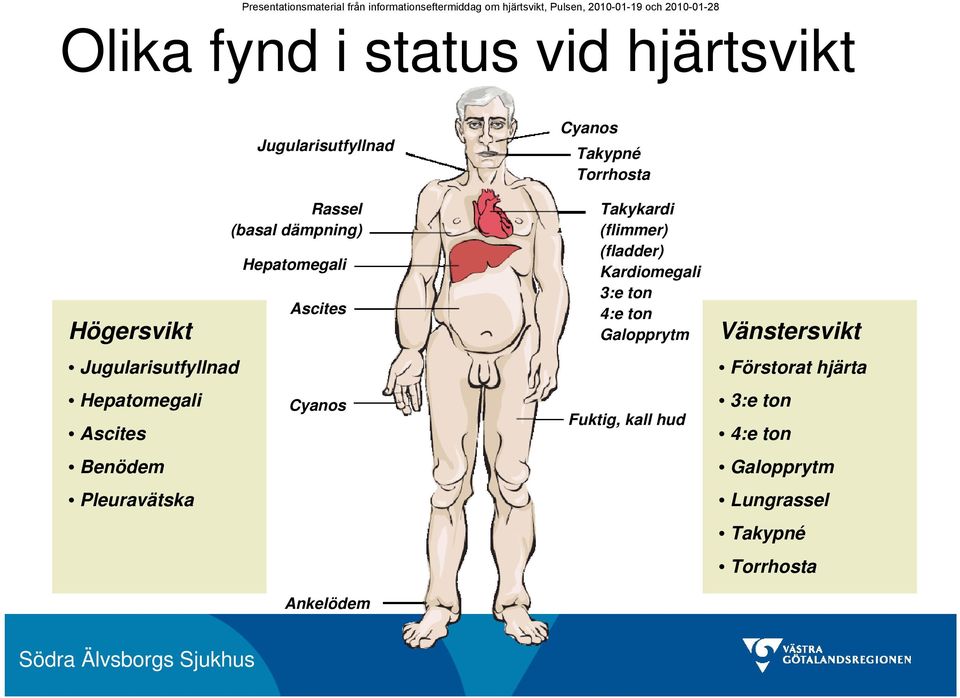 Cyanos Takypné Torrhosta Takykardi (flimmer) (fladder) Kardiomegali 3:e ton 4:e ton Galopprytm