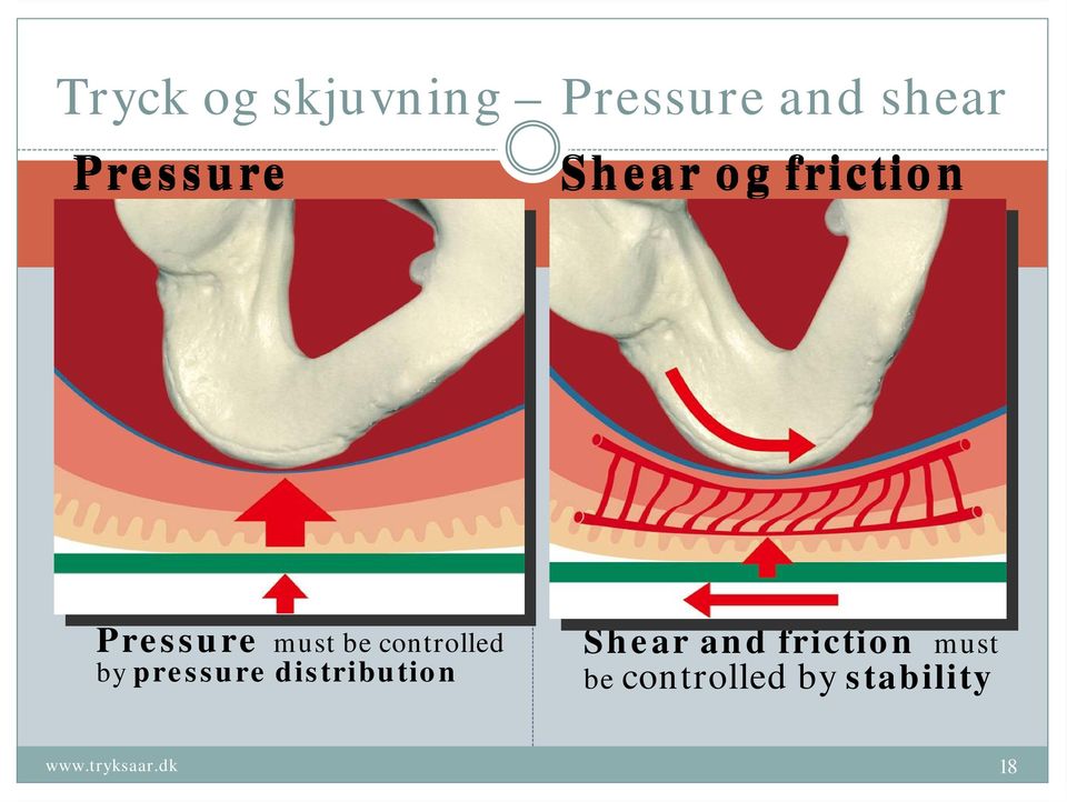 be controlled by pressure distribution