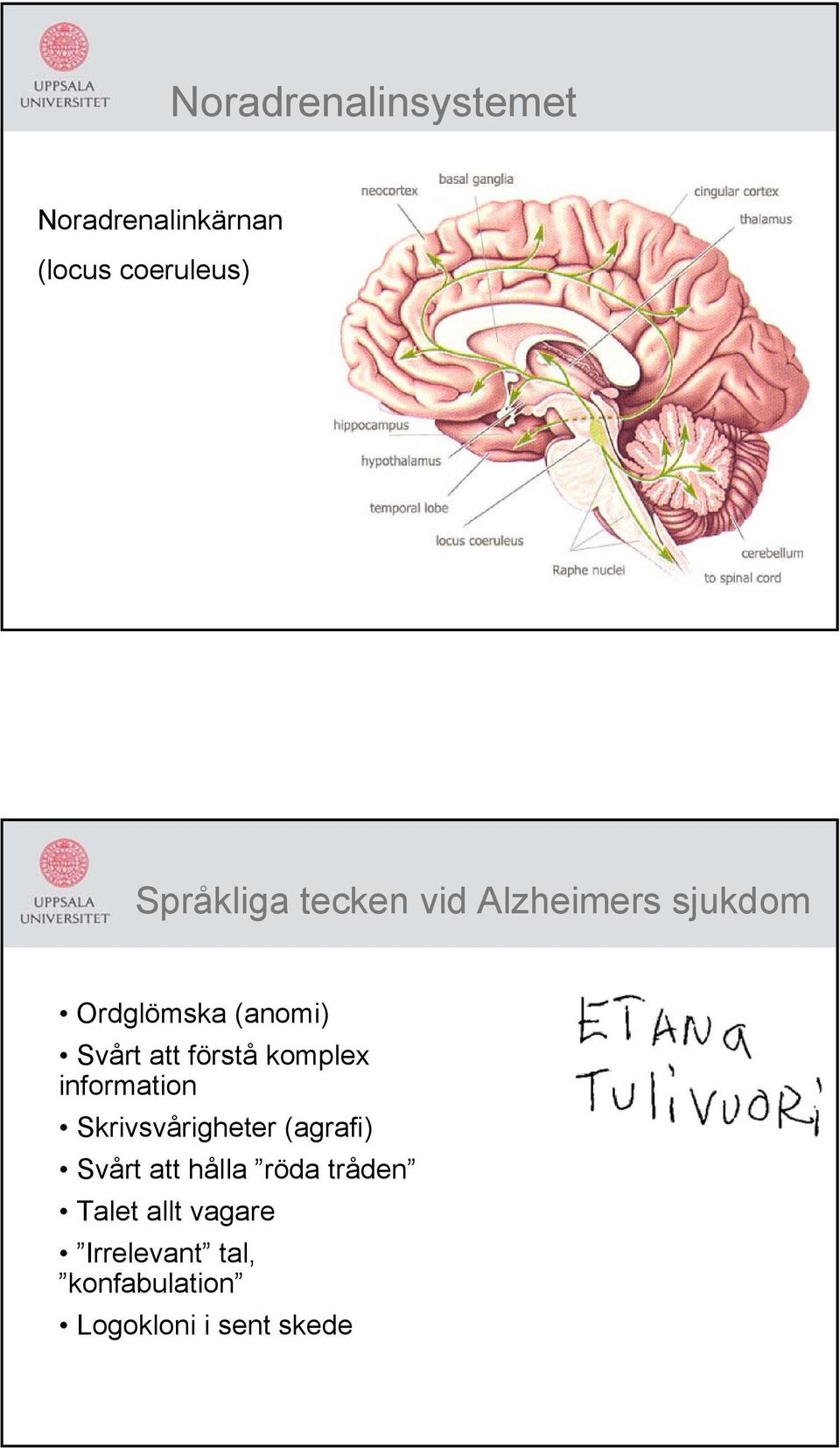 förståkomplex information Skrivsvårigheter (agrafi) Svårt att hålla