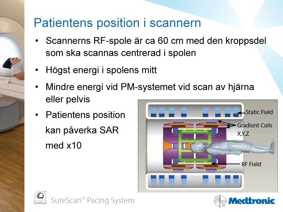 energi i spolens mitt Mindre energi vid PM-systemet vid scan