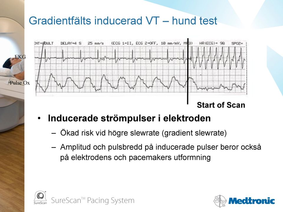 slewrate (gradient slewrate) Amplitud och pulsbredd på