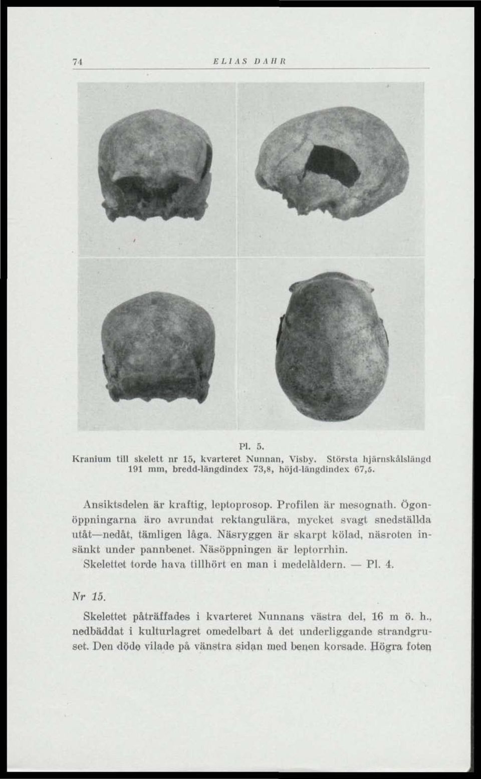 Näsryggen är skarpt kölad, näsroten insänkt under pannbenet. Näsöppningen är loptorrhin. Skelettol torde hava tillhört en man i medelåldern. Pl. 4. Nr 15.