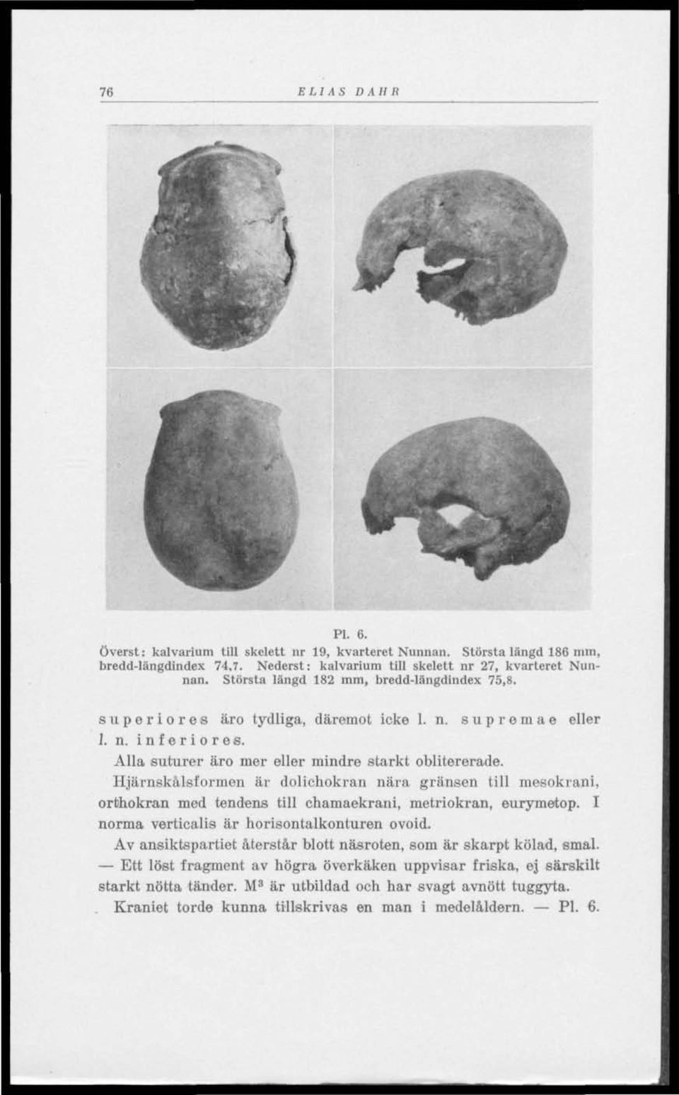 Hjärnskålsformen är dolichokran nära gränsen till mesokrani, orthokran med tendens till chamaekrani, metriokran, eurymetop. I norma verticalis är horisontalkonturen ovoid.