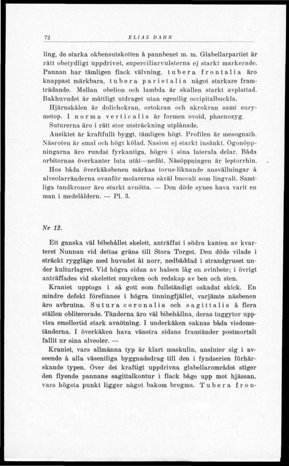 Bakhuvudet är måttligt utdraget utan egentlig occipitalbuckla. Hjärnskålen är dolichokran, ortokran och akrokran samt eurymetop. I norma verticalis är formen ovoid, phaenozyg.