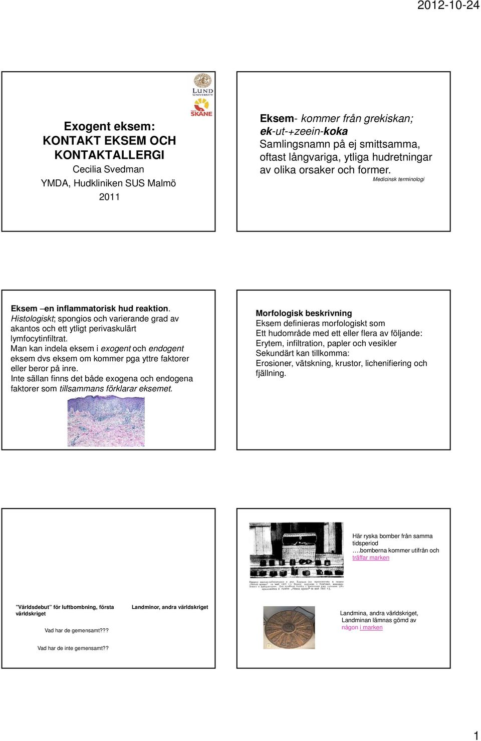 Histologiskt; spongios och varierande grad av akantos och ett ytligt perivaskulärt lymfocytinfiltrat.