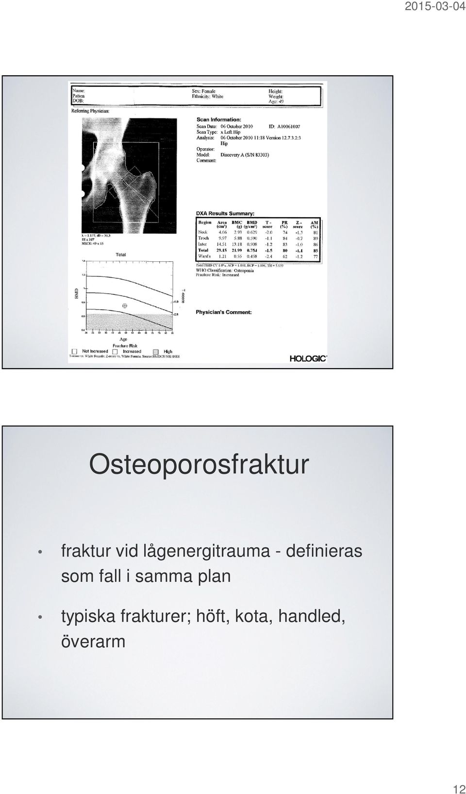 fall i samma plan typiska