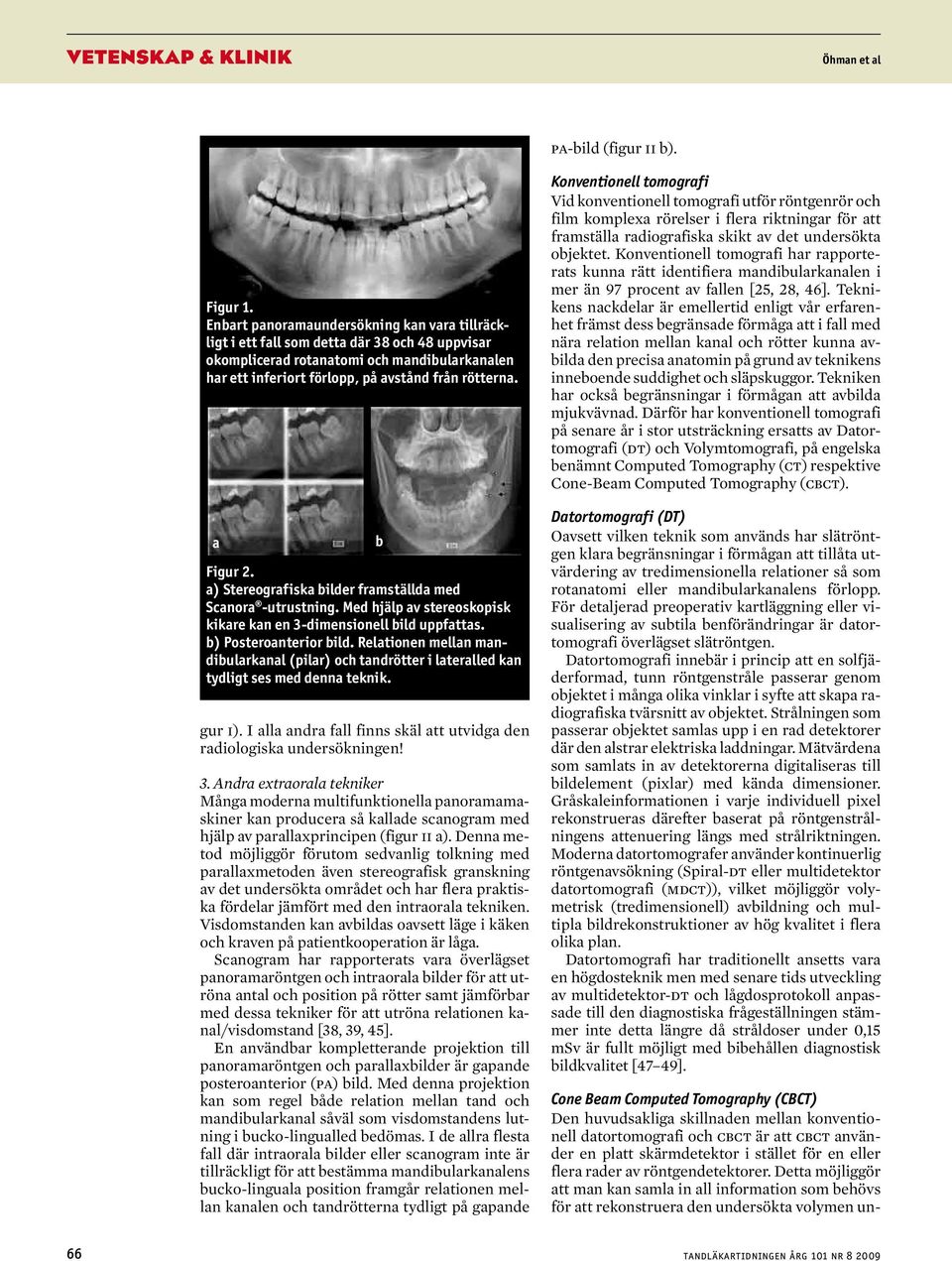 Cone Bem Computed Tomogrphy (CBCT) Den huvudsklig skillnden melln konventionell dtortomogrfi oh t är tt t nvänder en pltt skärmdetektor i stället för en eller fler rder v röntgendetektorer.