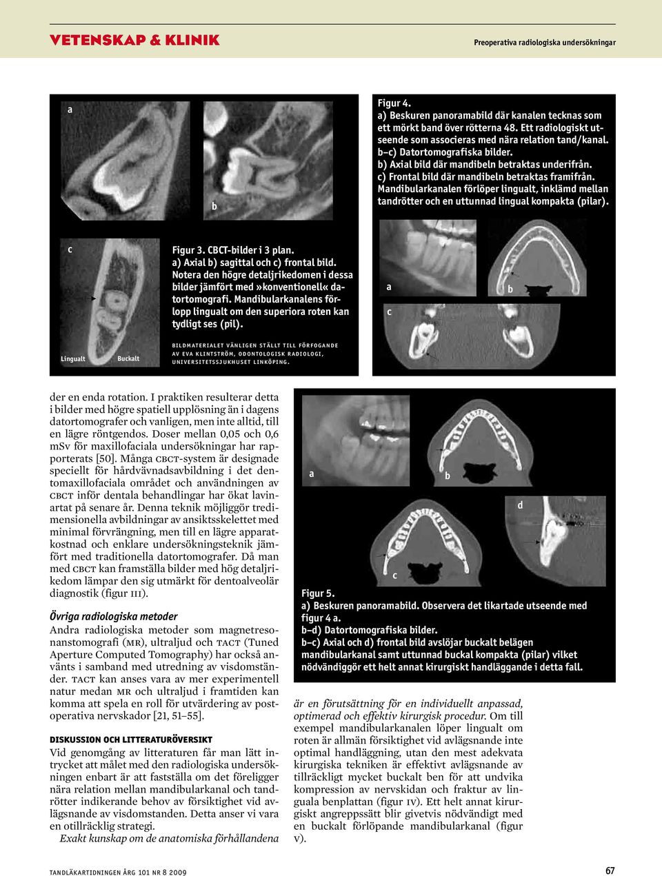 CBCT-ilder i 3 pln. ) Axil ) sgittl oh ) frontl ild. Noter den högre detljrikedomen i dess ilder jämfört med»konventionell«dtortomogrfi.