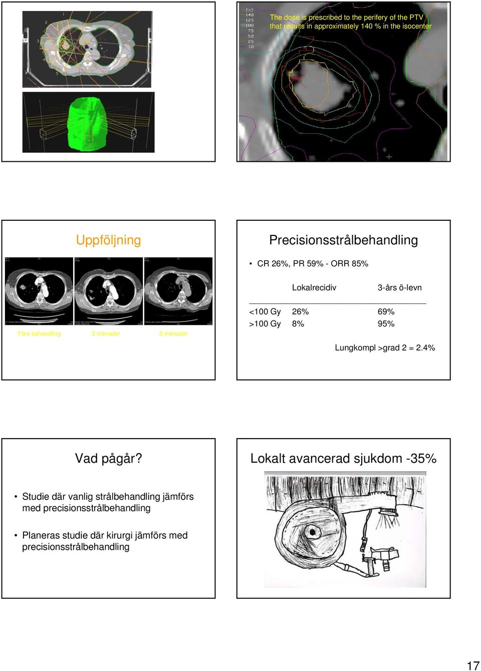 3-års ö-levn <100 Gy 26% 69% >100 Gy 8% 95% Lungkompl >grad 2 = 2.4% Vad pågår?