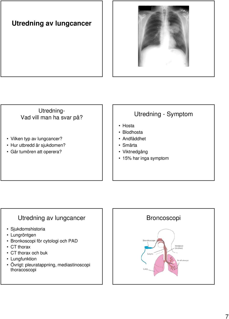 Utredning - Symptom Hosta Blodhosta Andfåddhet Smärta Viktnedgång 15% har inga symptom Utredning av