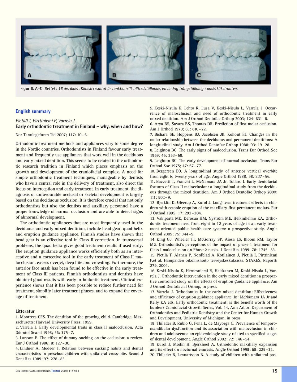 Orthodontists in Finland favour early treatment and frequently use appliances that work well in the deciduous and early mixed dentition.