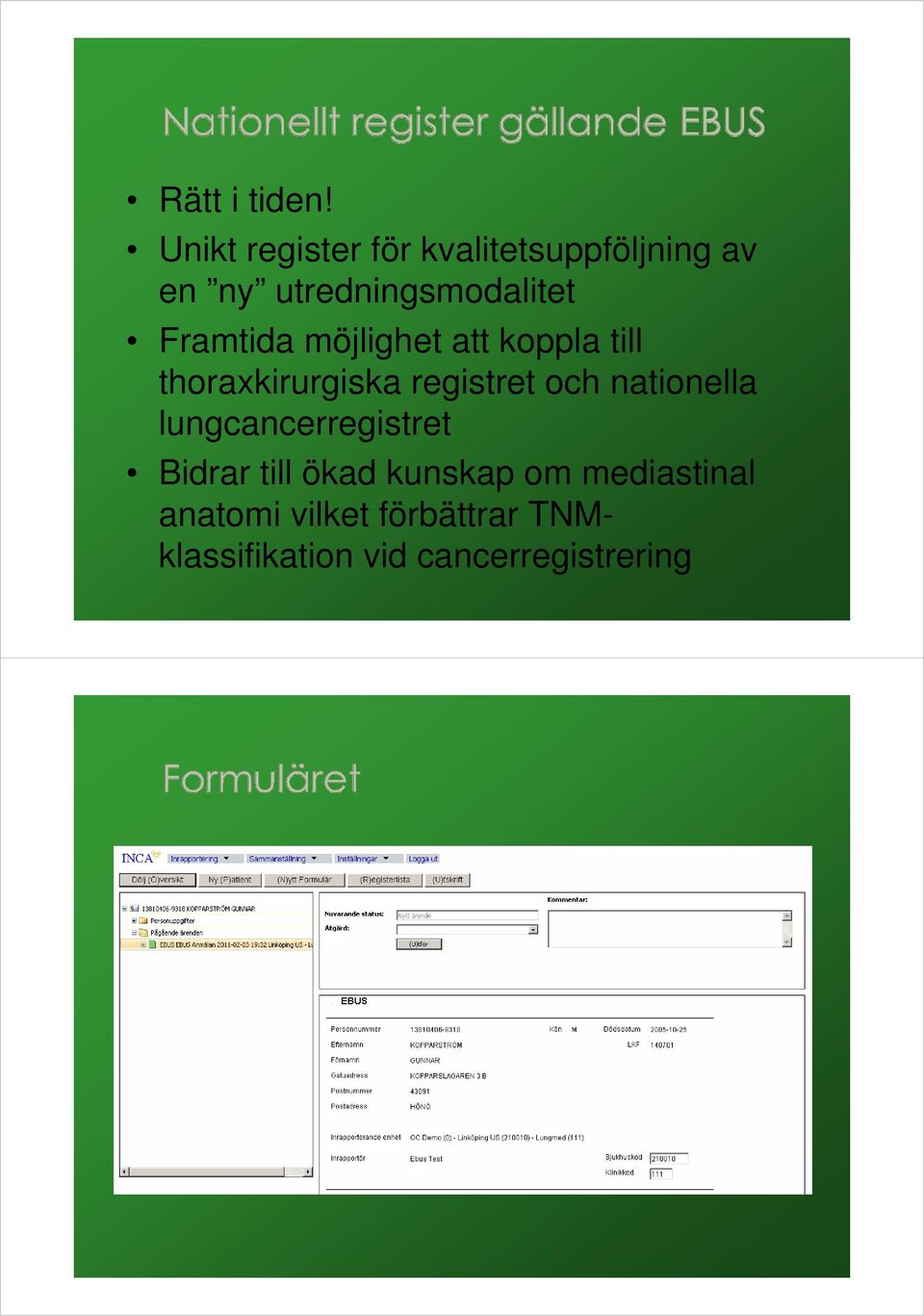 Framtida möjlighet att koppla till thoraxkirurgiska registret och