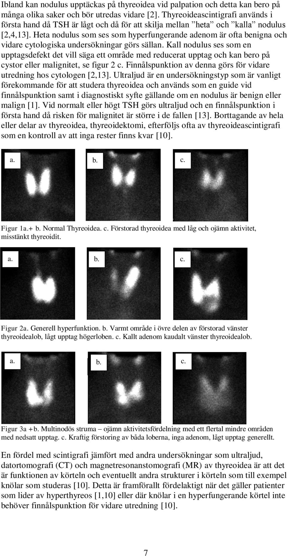 Heta nodulus som ses som hyperfungerande adenom är ofta benigna och vidare cytologiska undersökningar görs sällan.