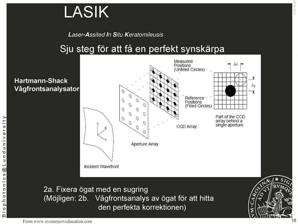 Fixera ögat med en sugring (Möjligen: 2b.