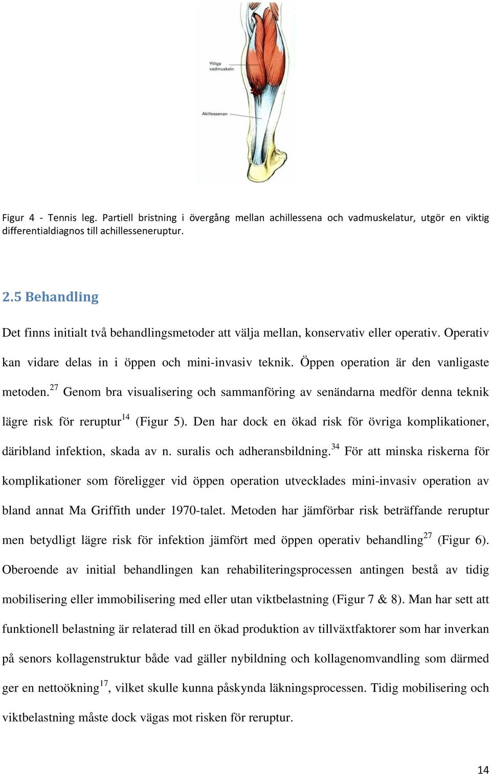 Öppen operation är den vanligaste metoden. 27 Genom bra visualisering och sammanföring av senändarna medför denna teknik lägre risk för reruptur 14 (Figur 5).